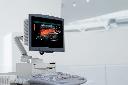 Siemens ultrasound