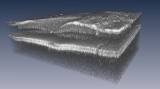 3-D cut-away view of a human retina in vivo