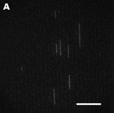 DNA stretching in the channels