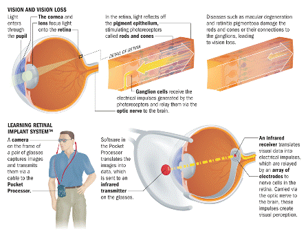 The IMI Learning Retinal Implant System 