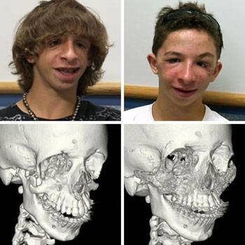 Images before and after surgery
