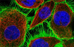 An image from the Human Protein Atlas 