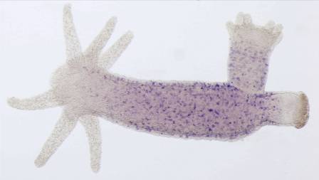 Expression of a cancer gene in an ancestral metazoan (blue)