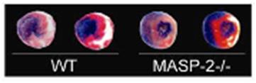 Differences in infarct sizes between presence and absence of MASP-2
