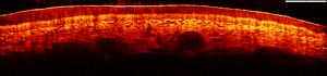 OCT image of the skin of a finger