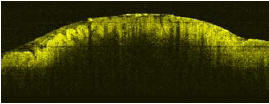 OCT image of oesophagus