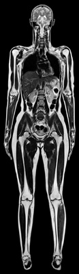 Whole body imaging with high resolution acquired in just 6 minutes.