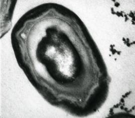Fish tuberculosis spore